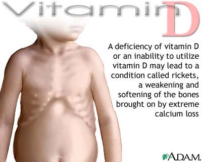vitamin-d