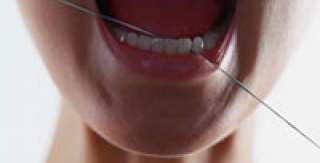 Phòng ngừa sâu răng như thế nào?