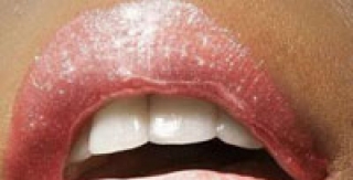 Điều trị răng sứ thẩm mỹ tại AVA mất bao lâu?