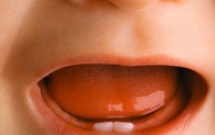 Chăm sóc nướu và răng sữa của trẻ 