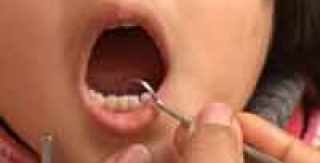 Chăm sóc răng cho trẻ nhỏ