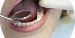 Tại sao có người sau nhổ răng thì đau rất nhiều có khi kéo dài hàng tuần? 