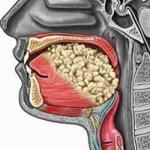 Ung thư khoang miệng cần phát hiện sớm