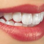  Những thực phẩm dễ gây sâu răng