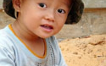 Có cần phải chăm sóc các răng sữa cho đến khi các răng này được thay thế