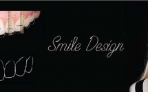 NHA KHOA THẨM MỸ (Niềng răng- Phục hình- Nha chu)