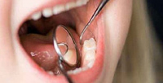 Làm sao phát hiện được sâu răng? 