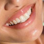 Phòng và trị viêm lợi 