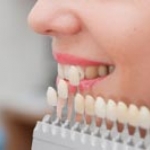 RĂNG SỨ CHO HÀM GIẢ THÁO LẮP