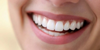 Giải pháp toàn diện cho nụ cười đẹp