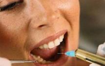 Lời khuyên của BS RHM đối với bệnh nhân nhổ răng