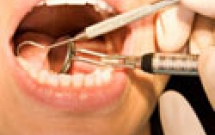 Vệ sinh răng miệng hàng ngày chỉ chải răng là đủ? 
