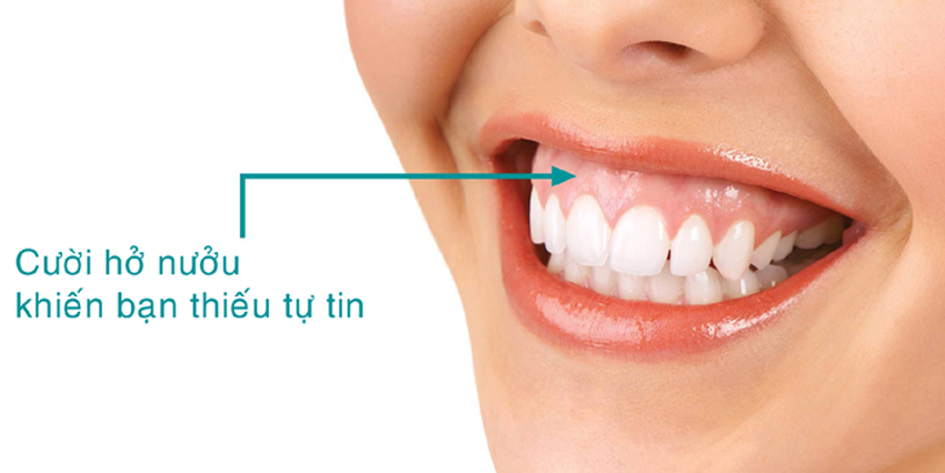 cuoi ho nuou 21