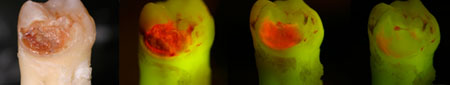 facelight-minimally-invasive 
