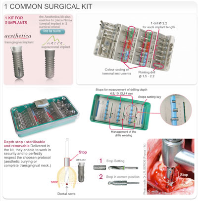 he-thong-implant-france-tai-ava