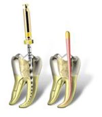 protaper