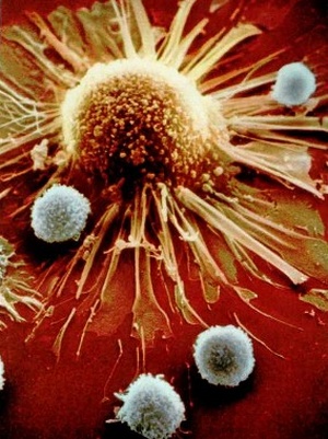 HIV1